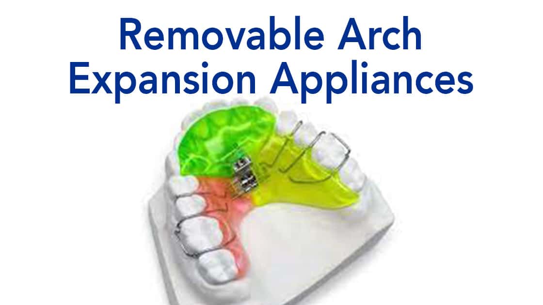 Removable arch image